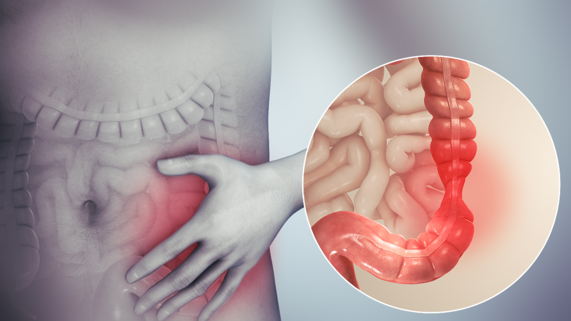Síndrome do Intestino Irritável: Entenda os Sintomas e Recupere o Controle da Sua Rotina